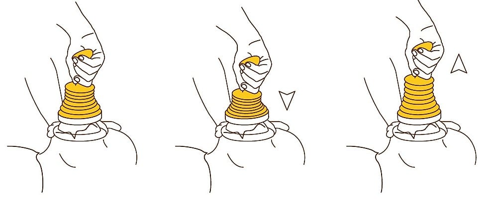 Schéma montrant le fonctionnement du dispositif anti-étouffement LifeVac
